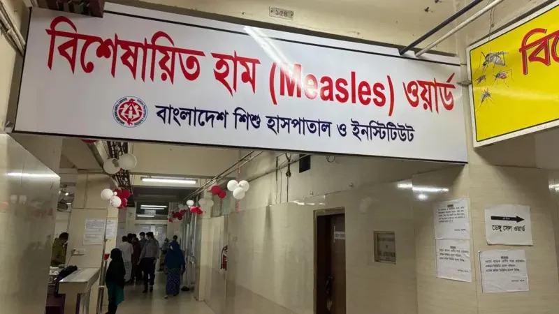 হামের উপসর্গে ৬ শিশুর মৃত্যু, সবাই ঢাকার